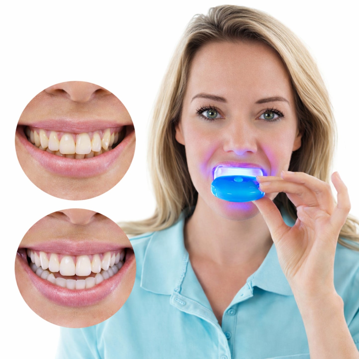 Denteva™ Glow Accelerator